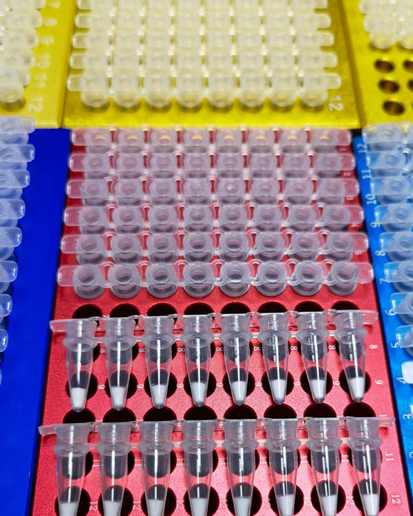 Diagnostic Reagents Lyophilization Solution Diagnostic Kits Freeze Drying Example